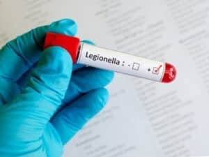 Una mano guantata in lattice tiene un campione con etichetta "Legionella" e una casella di controllo per risultato positivo o negativo dell'analisi legionella.